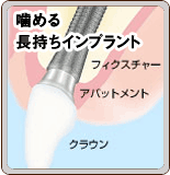 噛める長持ちインプラント